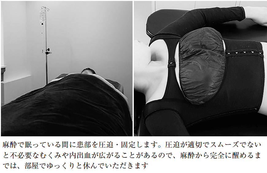 ④看護師による適切な圧迫・固定