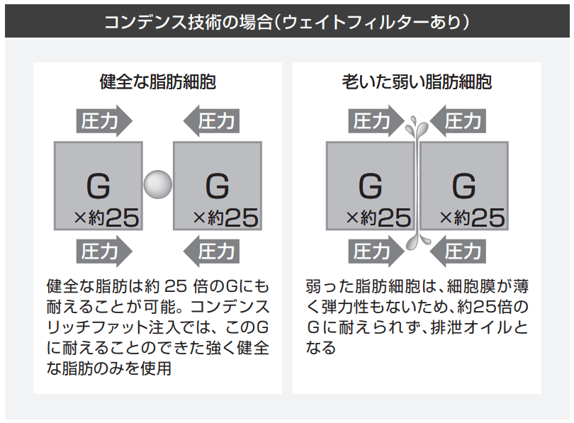 コンデンス技術の場合