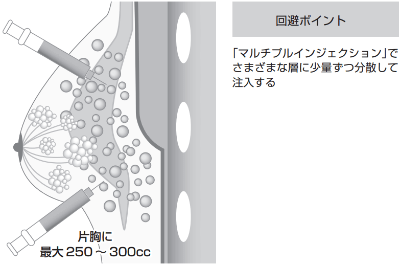 回避ポイント