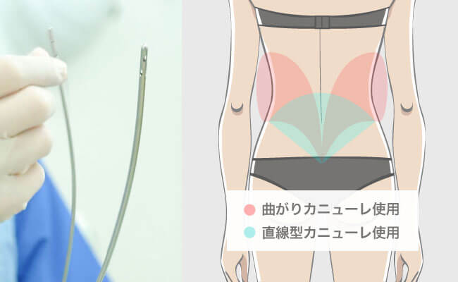 ワンランク上のボディデザインが可能