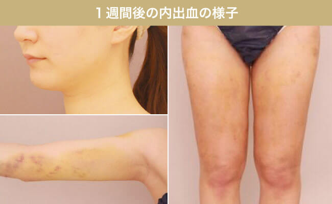 ダウンタイムを軽減できる