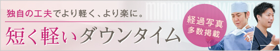 短く軽いダウンタイム