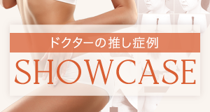 SHOWCASE