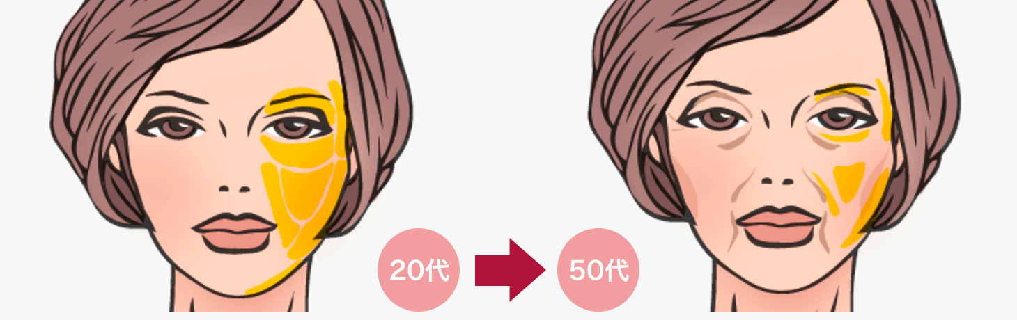年齢とともに減少する脂肪のイメージ