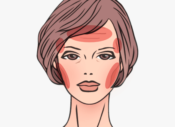 コンデンスリッチフェイスの適応部位