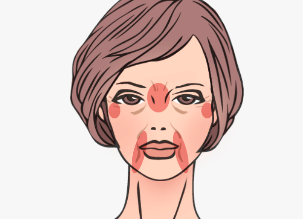 マイクロCRFの適応部位