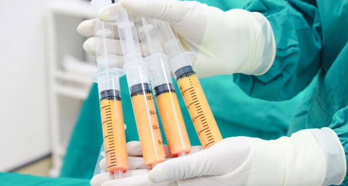 吸引した脂肪を有効活用