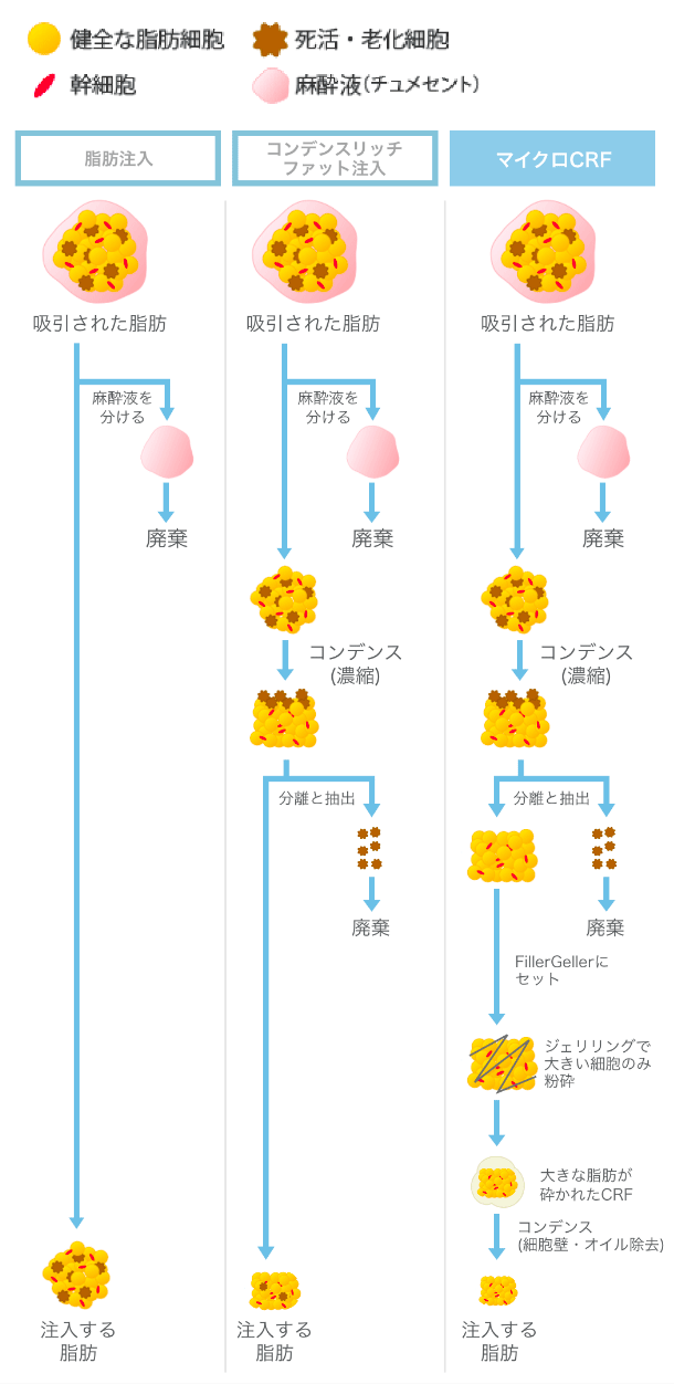 従来の注入系技術の問題点をクリアの図説