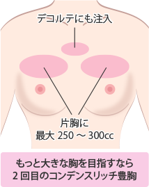 自然で美しいバストのライン