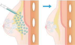 適正に注入された場合