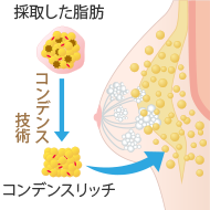 コンデンスリッチの場合