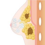 まとめて注入した場合