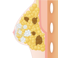 注入量が多すぎる場合