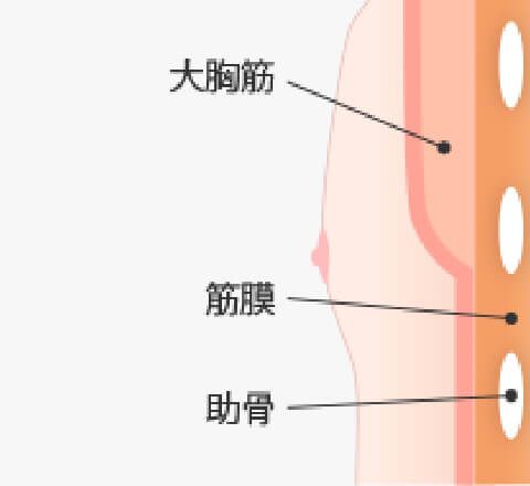 女性化乳房 Mods Clinic モッズクリニック 公式 東京 銀座 大阪 女性化乳房 Mods Clinic モッズクリニック 公式 東京 銀座 大阪