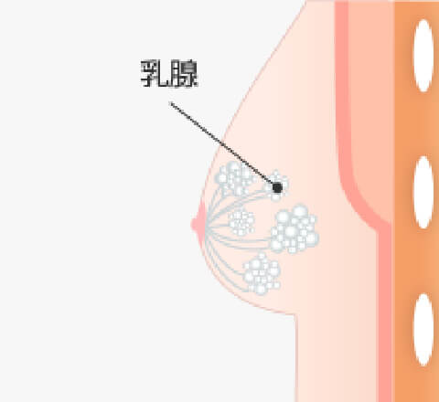 真性女性化乳房
