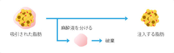 従来の脂肪吸引のイメージ