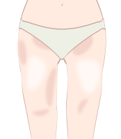 ガタガタのライン