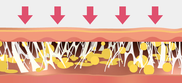 3）皮膚のタイトニング