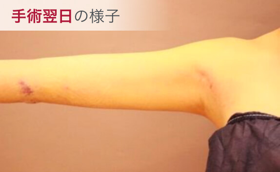 手術翌日の様子