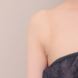 脇肉の脂肪吸引【術前／6ヶ月 31歳女性】の術後写真