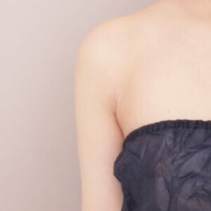脇肉の脂肪吸引【術前／6ヶ月 23歳女性】の術後写真