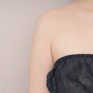 脇肉の脂肪吸引【術前／6ヶ月 30歳女性】の術後写真