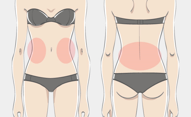 側腹部前後の脂肪を集中的に吸引