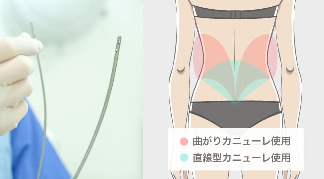 隣接部分との境目はなめらかに吸引