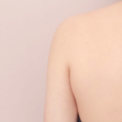 二の腕+肩の脂肪吸引【27歳女性】の術後写真