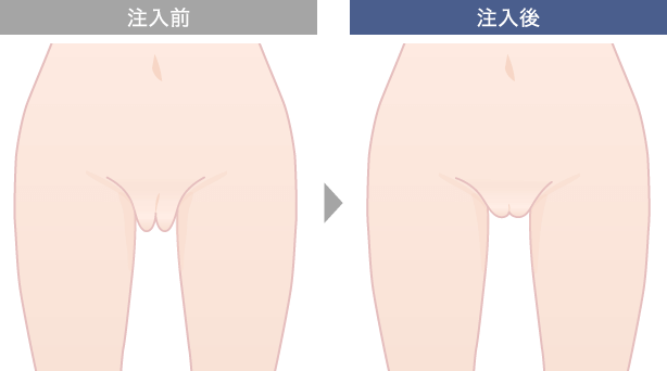 注入後のイメージ