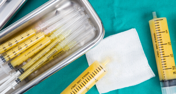 しこりのリスクを抑えた注入法