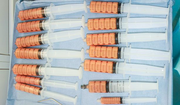 コンデンスリッチファット注入