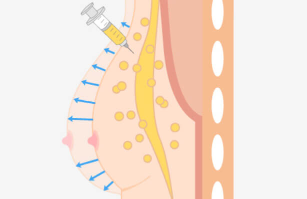 サイズダウンが少ないのイメージ